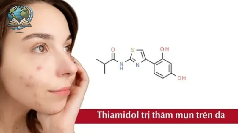 Cách trị mụn thâm nhanh chóng với nguyên liệu thiên nhiên