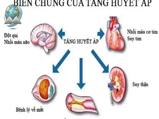 Hướng dẫn cách hạ huyết áp nhanh không cần thuốc hiệu quả