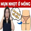 Cách trị mụn ở mông nhanh chóng và hiệu quả ngay tại nhà