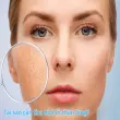 Bí quyết áp dụng cách thu nhỏ lỗ chân lông cực kỳ hiệu quả