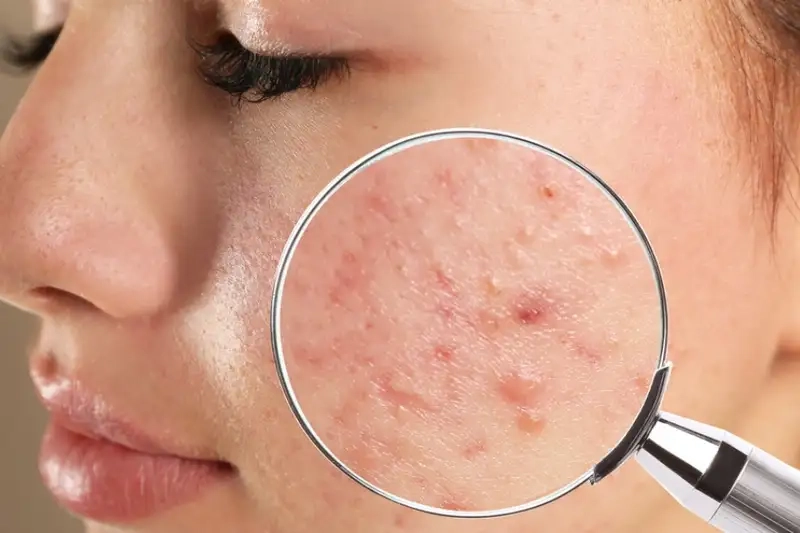 Lưu ý trong quá trình chăm sóc da