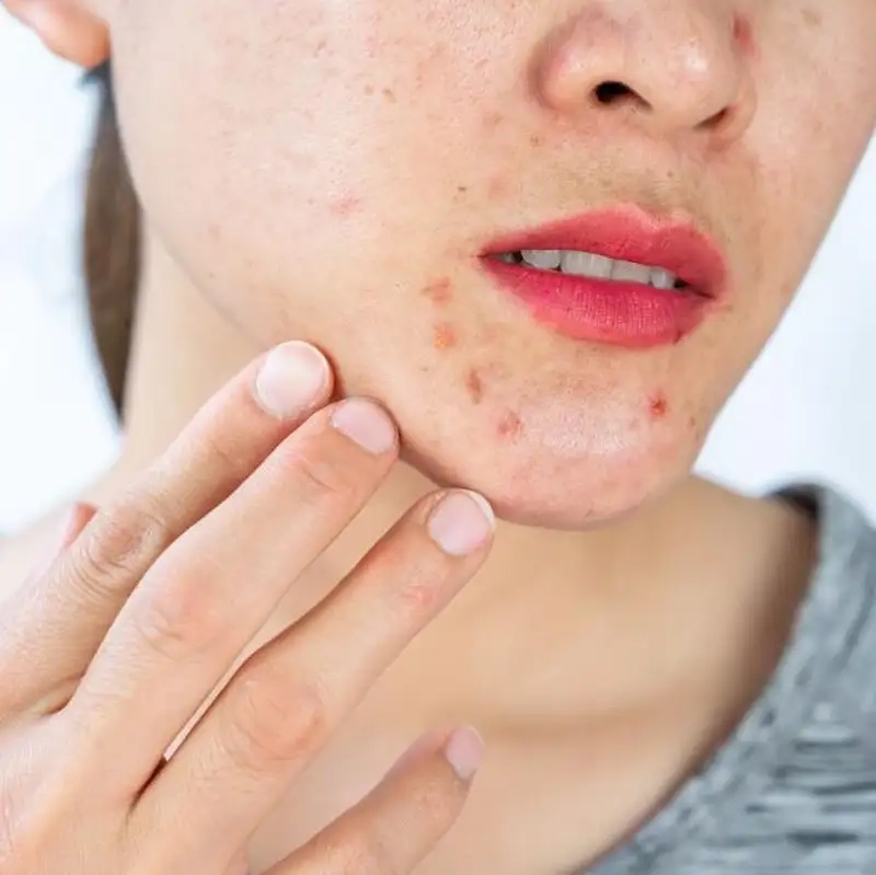 Khi nào nên tìm đến chuyên gia da liễu