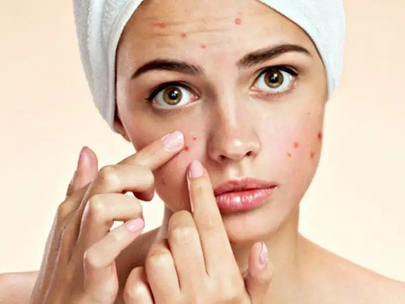 Lưu ý quan trọng trong quá trình chăm sóc da