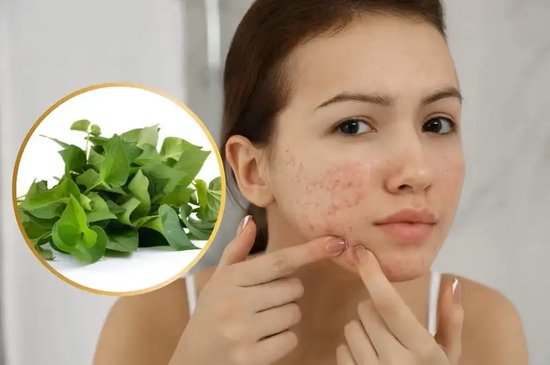 Lưu ý khi dùng rau diếp cá làm đẹp