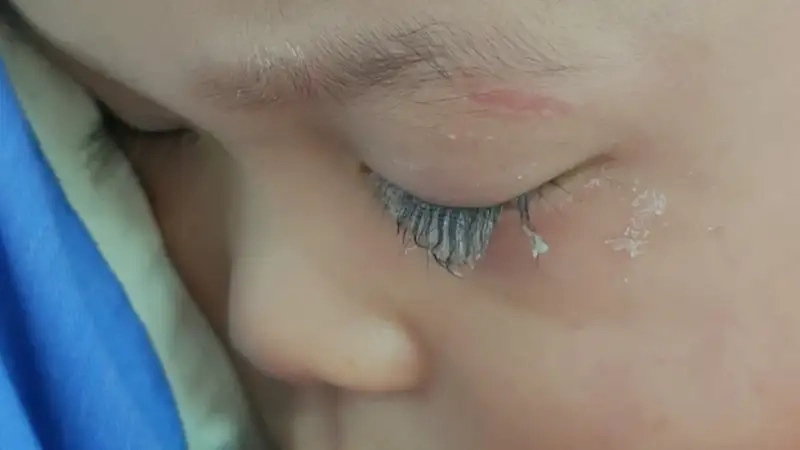 Những tác hại thường gặp khi sử dụng keo 502