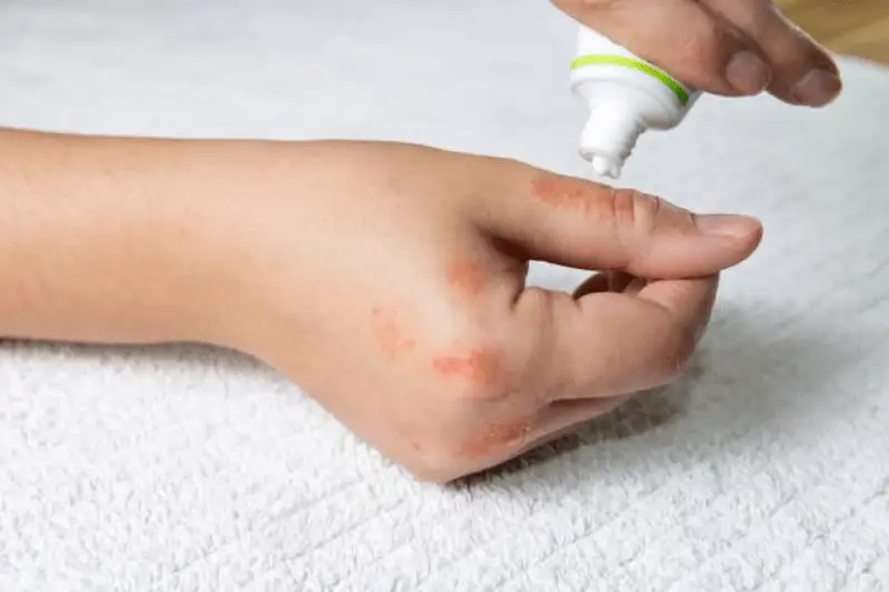 Kinh nghiệm phòng tránh kiến 3 khoang hiệu quả