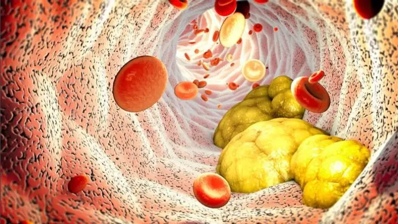 Ảnh hưởng của Omega-6 đến hệ thần kinh và tinh thần