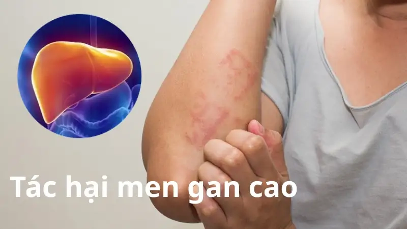 Men gan cao là gì và nguyên nhân phổ biến