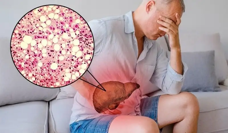 Kinh nghiệm kiểm soát và phòng ngừa men gan cao