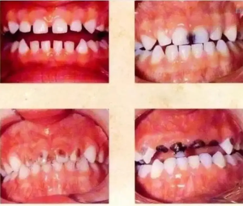 Ảnh hưởng giấc ngủ và thói quen sinh hoạt