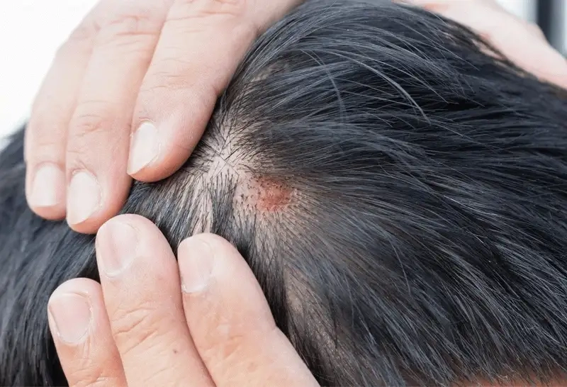 Nguy cơ sức khỏe tiềm ẩn từ thuốc nhuộm tóc