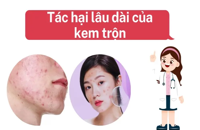 Dấu hiệu da bị tổn hại nghiêm trọng sau khi dùng kem trộn