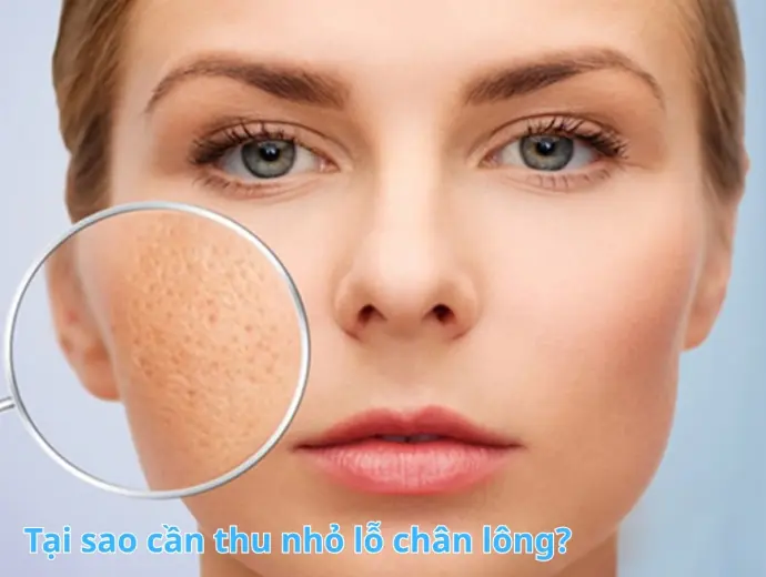 Bí quyết áp dụng cách thu nhỏ lỗ chân lông cực kỳ hiệu quả