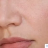 Bí Quyết Lựa Chọn Sản Phẩm Skincare Cho Da Dầu Mụn Lỗ Chân Lông To