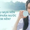 Kem nền cho da dầu mụn: Lựa chọn hoàn hảo che phủ khuyết điểm