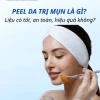 Peel da có đẩy mụn không và cách xử lý hiệu quả