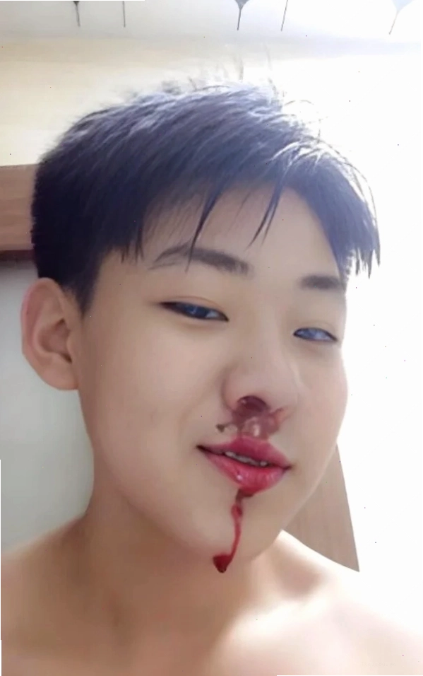 Ảnh meme chảy máu mũi thể hiện sự ngưỡng mộ