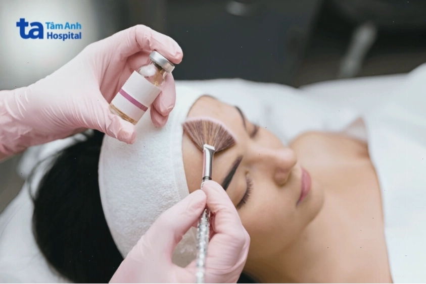 Các yếu tố ảnh hưởng đến thời gian đẩy mụn sau peel da
