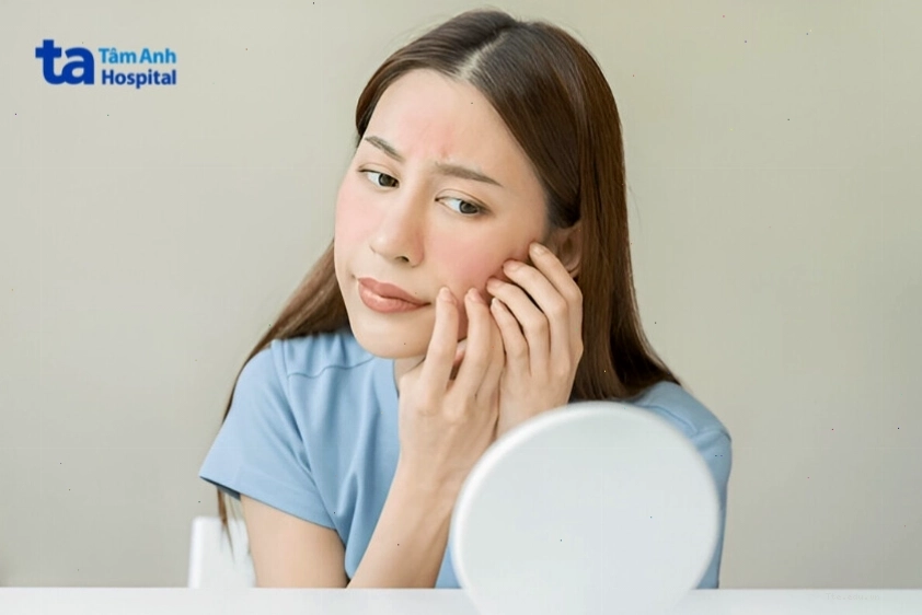 Cảm giác bình thường sau khi đẩy mụn là khi nhân mụn gom cồi
