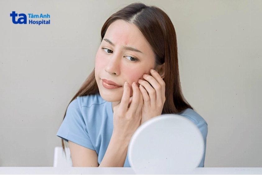 Cảm giác bình thường sau khi peel da đẩy mụn