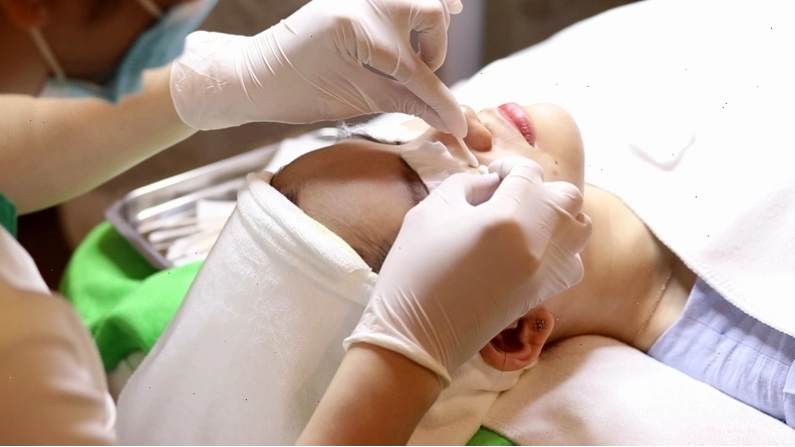 Da sau nặn mụn cần được chăm sóc nhẹ nhàng để phục hồi