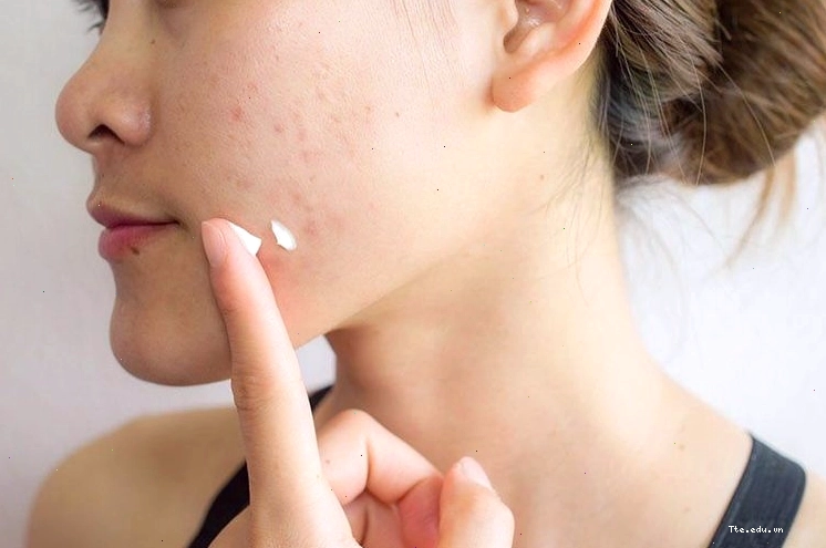 Kem dưỡng ẩm giúp phục hồi và duy trì hàng rào bảo vệ da