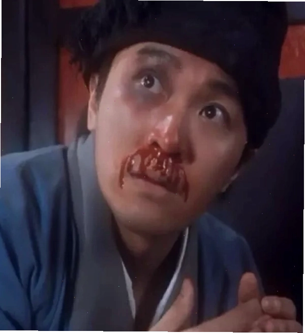 Me me chảy máu mũi