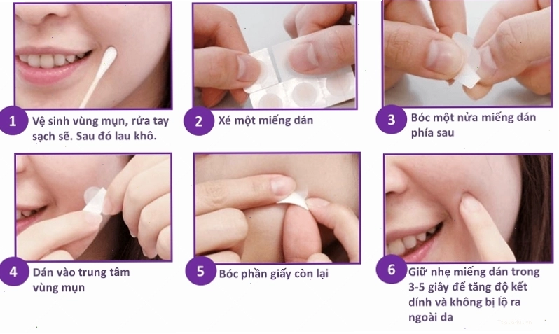 Miếng dán mụn có thật sự hiệu quả hay không cũng phụ thuộc nhiều ở cách bạn dùng nó