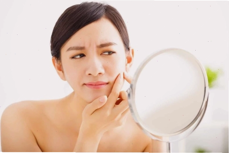 Nặn mụn không đúng cách làm tình trạng mụn nghiêm trọng hơn