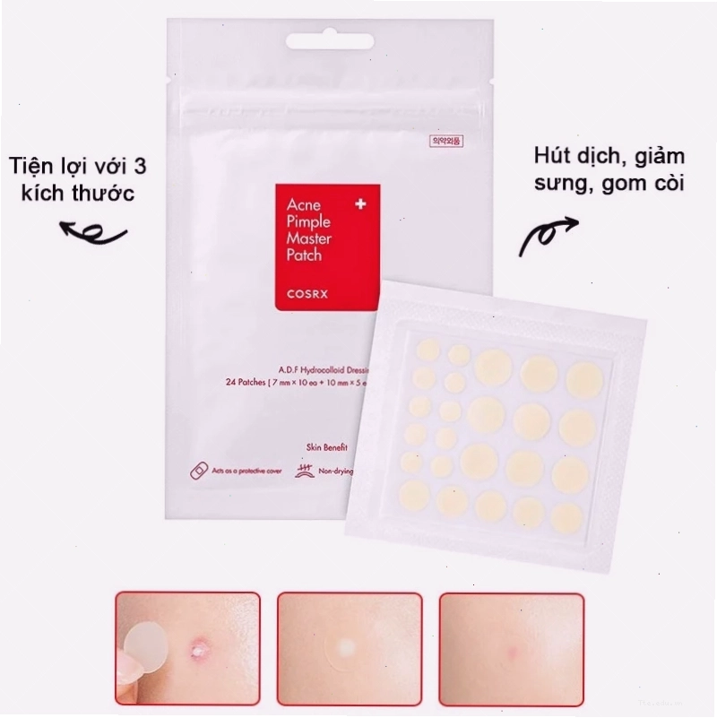 So sánh các loại miếng dán mụn hiệu quả