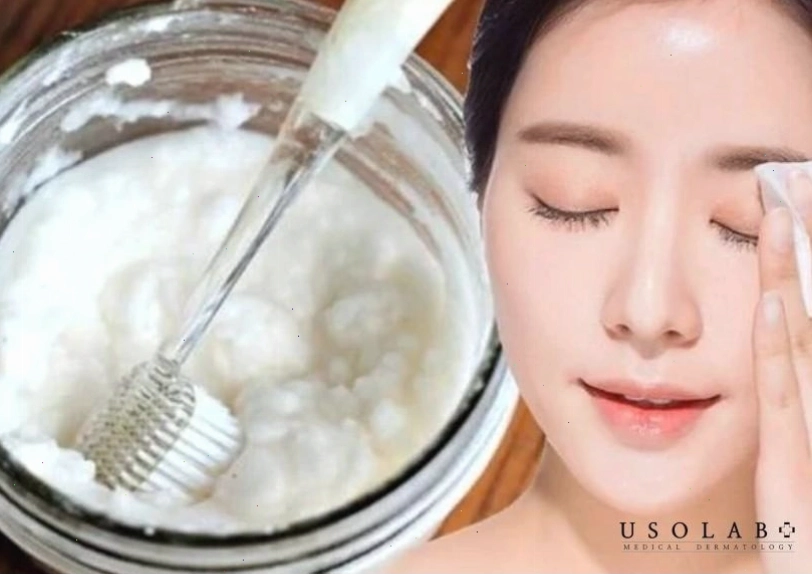 Tuyệt đối tránh dùng sữa chua có đường cho da mụn vì đường có thể làm tình trạng mụn nặng hơn