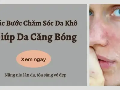 Các bước chăm sóc da khô hiệu quả để làn da luôn mềm mịn