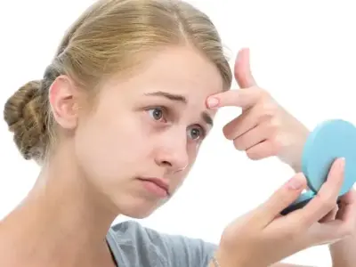 Cách trị mụn cho trẻ 10 tuổi tại nhà hiệu quả nhanh chóng
