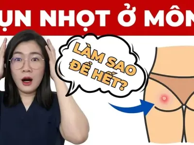 Cách trị mụn ở mông nhanh chóng và hiệu quả ngay tại nhà