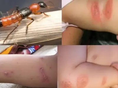 Tác hại của kiến 3 khoang và cách phòng tránh hiệu quả nhất