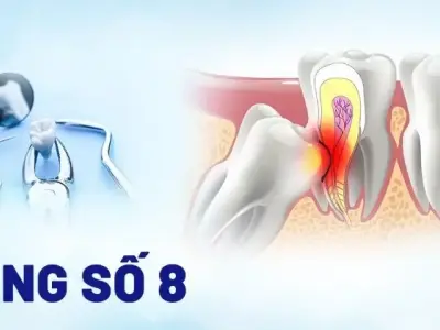 Tác hại của răng số 8: Nhận biết và phòng ngừa hiệu quả