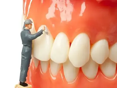 Tác hại của việc lấy cao răng quá nhiều đến răng miệng