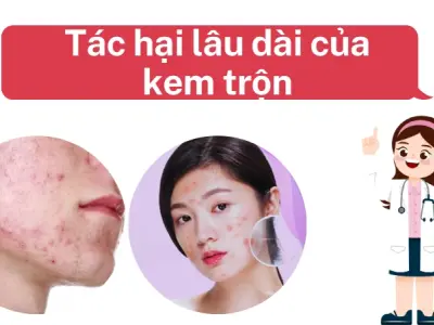 Dấu hiệu da bị tổn hại nghiêm trọng sau khi dùng kem trộn