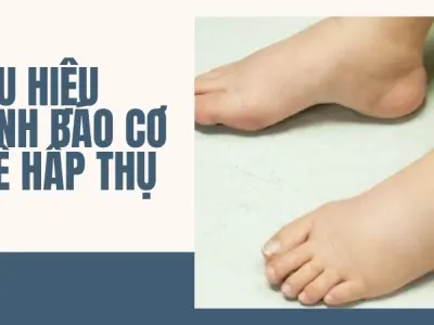 Dấu hiệu cơ thể thừa muối và những hiểm họa khó lường