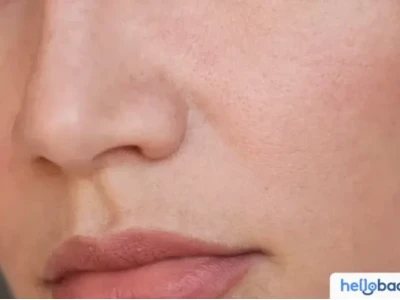 Bí Quyết Lựa Chọn Sản Phẩm Skincare Cho Da Dầu Mụn Lỗ Chân Lông To