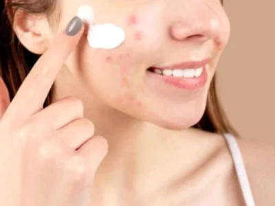 Các Bước Skincare Cho Da Dầu Mụn Đúng Chuẩn Chuyên Gia 2026