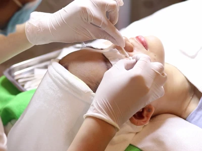 Chăm sóc da sau nặn mụn: Bí quyết phục hồi, ngừa thâm và sẹo hiệu quả