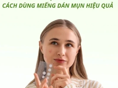 Miếng Dán Hút Mụn Hiệu Quả Nhất Hiện Nay 2026: Hướng Dẫn Chọn Lựa